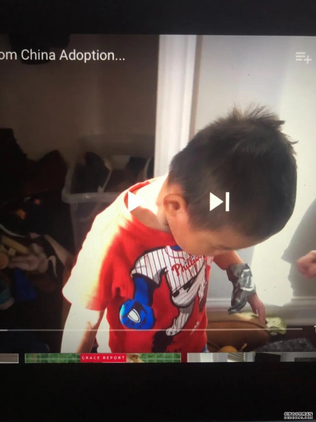 那个被网红育儿博主弃养的中国残障男孩疑似遭受虐待,甚至还失踪